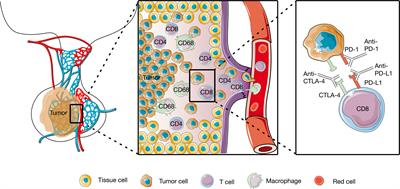 The Progress of Immunotherapy in Refractory Pituitary Adenomas and Pituitary Carcinomas